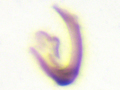 Psammotettix cephalotes